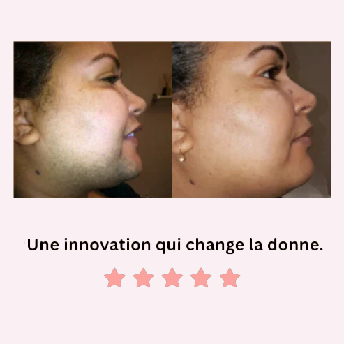 Méloria® – Crème dépilatoire visage & zones sensibles
