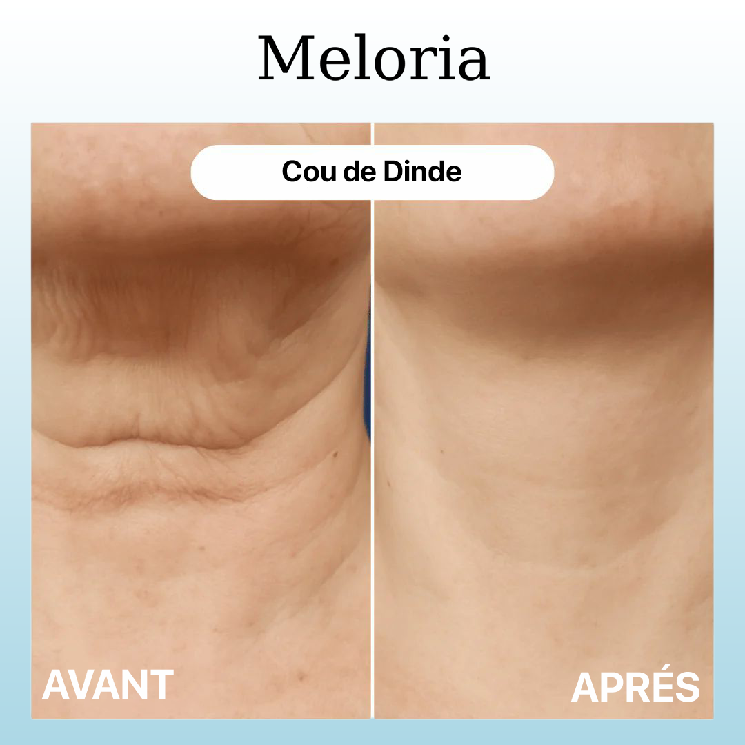 Meloria® – Sérum Peptide collagène