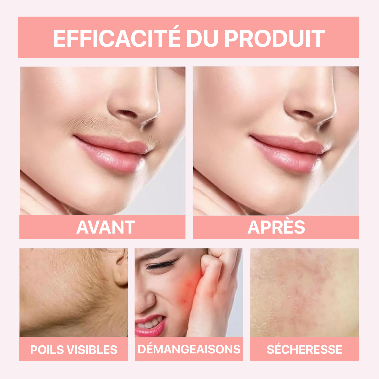 Méloria® – Crème dépilatoire visage & zones sensibles
