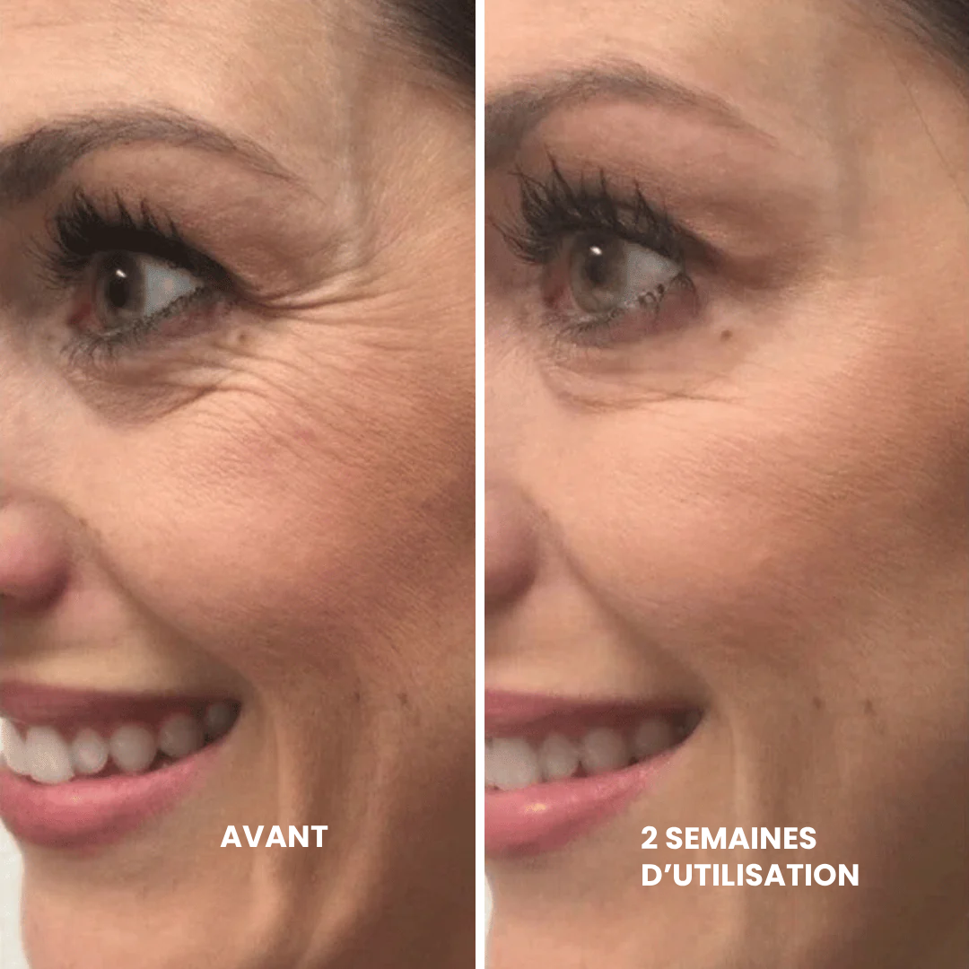 Meloria™ L’alternative nouvelle génération au rétinol