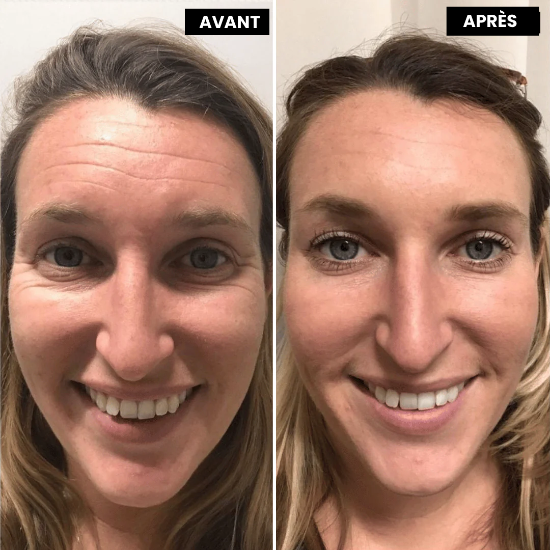 Meloria™ L’alternative nouvelle génération au rétinol