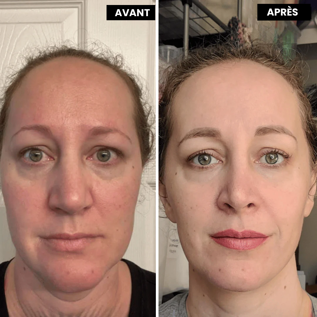 Meloria™ L’alternative nouvelle génération au rétinol